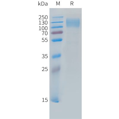 sp-PME C100033 CEACAM5 Fig.1 SDS PAGE 1