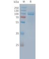 sp-PME C100035 PSMA Fig.1 SDS PAGE 1