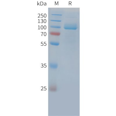 sp-PME C100035 PSMA Fig.1 SDS PAGE 1