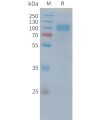 sp-PME C100036 EGFR Fig.1 SDS PAGE 1