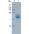 sp-PME C100037 CD3E Fig.1 SDS PAGE 1