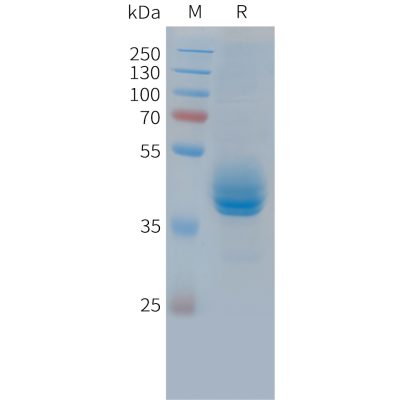 sp-PME C100037 CD3E Fig.1 SDS PAGE 1