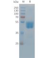 sp-PME C100038 TIGIT Fig.1 SDS PAGE 1