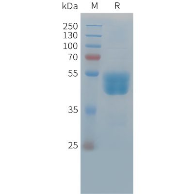 sp-PME C100038 TIGIT Fig.1 SDS PAGE 1