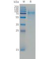 sp-PME C100052 CD30 Fig.1 SDS PAGE 1