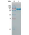 sp-PME M100077 PD L1 Fig.1 SDS PAGE 1