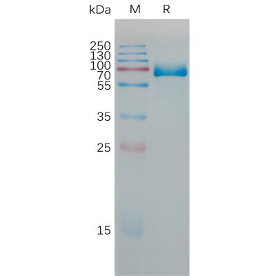 sp-PME M100077 PD L1 Fig.1 SDS PAGE 1