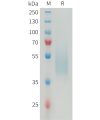 sp-PME M100078 B7 H4 Fig.1 SDS PAGE 1