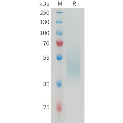 sp-PME M100078 B7 H4 Fig.1 SDS PAGE 1