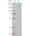 sp-PME M100081 CD45 Fig.1 SDS PAGE 1