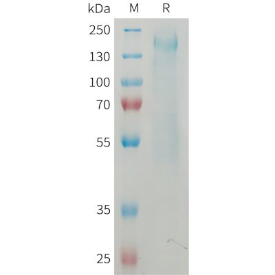 sp-PME M100081 CD45 Fig.1 SDS PAGE 1