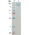 sp-PME M100083 SEZ6 Fig.1 SDS PAGE 1