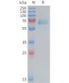 sp-PME M100084 EPHA2 Fig.1 SDS PAGE 1