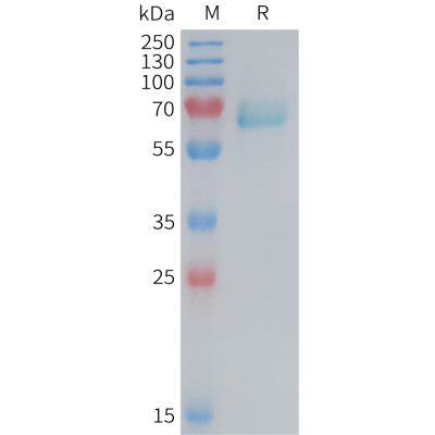 sp-PME M100084 EPHA2 Fig.1 SDS PAGE 1