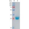 sp-PME M100085 CXADR Fig.1 SDS PAGE 1