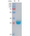 sp-PME M100085 CXADR Fig.1 SDS PAGE 1