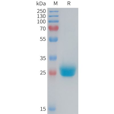 sp-PME M100085 CXADR Fig.1 SDS PAGE 1