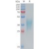sp-PME M100086 TNFRSF1B Fig.1 SDS PAGE 1