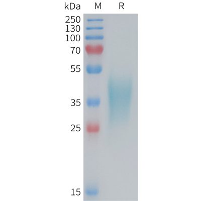 sp-PME M100086 TNFRSF1B Fig.1 SDS PAGE 1