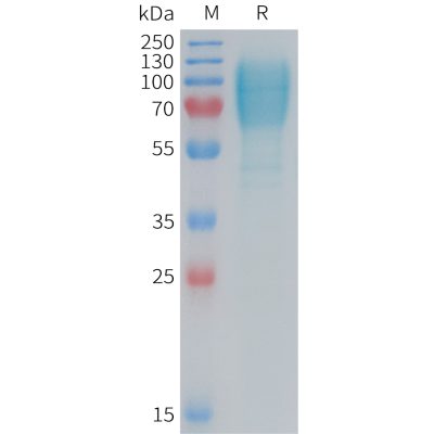 sp-PME M100087 GUCY2C Fig.1 SDS PAGE 1