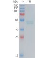 sp-PME M100088 IL11RA Fig.1 SDS PAGE 1