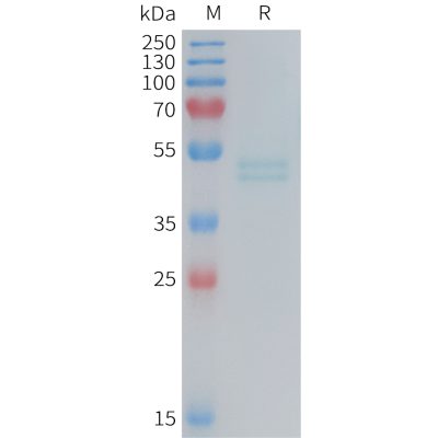 sp-PME M100088 IL11RA Fig.1 SDS PAGE 1