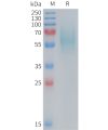 sp-PME M100089 5T4 Fig.1 SDS PAGE 1