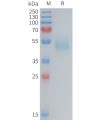 sp-PME M100090 TSLP Fig.1 SDS PAGE 1