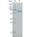 sp-PME M100092 AFP Fig.1 SDS PAGE 1