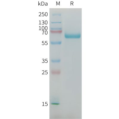 sp-PME M100092 AFP Fig.1 SDS PAGE 1