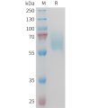 sp-PME M100094 AXL Fig.1 SDS PAGE 1