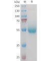 sp-PME M100095 CD70 Fig.1 SDS PAGE 1