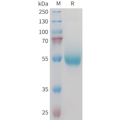 sp-PME M100095 CD70 Fig.1 SDS PAGE 1