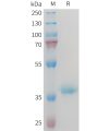 sp-PME M100096 IGF1 Fig.1 SDS PAGE 1