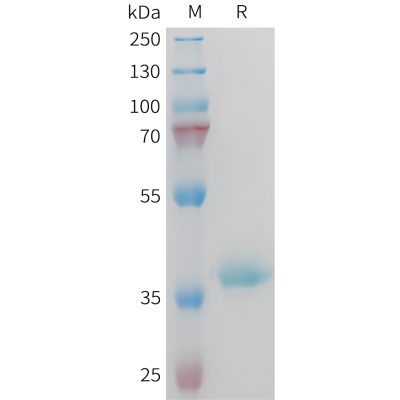 sp-PME M100096 IGF1 Fig.1 SDS PAGE 1