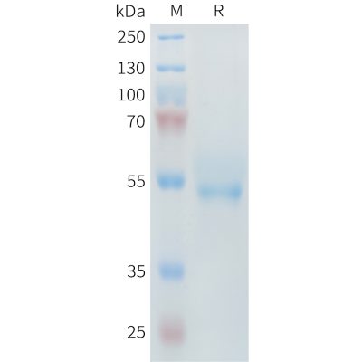 sp-PME M100097 ROR2 Fig.1 SDS PAGE 1