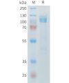 sp-PME M100098 CDH17 Fig.1 SDS PAGE 1