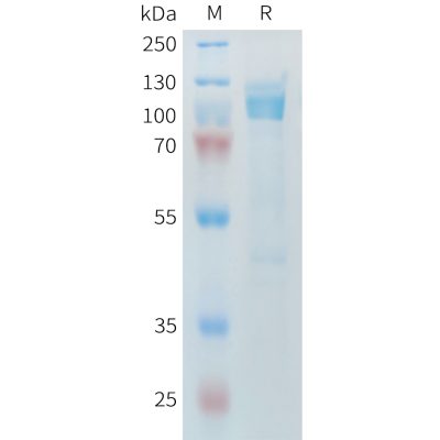 sp-PME M100098 CDH17 Fig.1 SDS PAGE 1