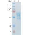 sp-PME M100099 PD 1 Fig.1 SDS PAGE 1