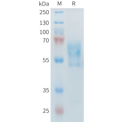 sp-PME M100099 PD 1 Fig.1 SDS PAGE 1