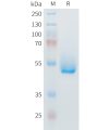 sp-PME M100100 IL6 Fig.1 SDS PAGE 1