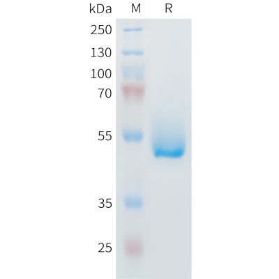 sp-PME M100100 IL6 Fig.1 SDS PAGE 1