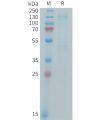 sp-PME M100101 IGF 1R Fig.1 SDS PAGE 1