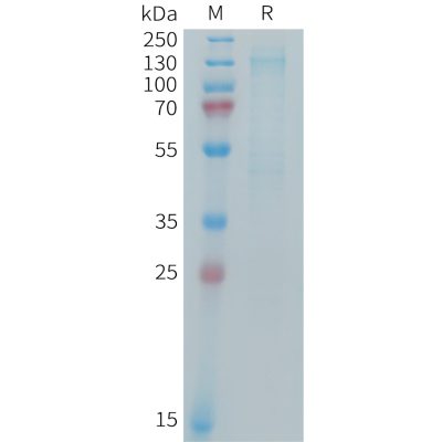 sp-PME M100101 IGF 1R Fig.1 SDS PAGE 1