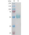 sp-PME M100102 TNFSF15 Fig.1 SDS PAGE 1