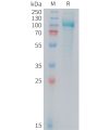 sp-PME M100103 PSMA Fig.1 SDS PAGE 1