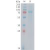 sp-PME M100104 TFRC Fig.1 SDS PAGE 1