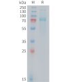 sp-PME M100104 TFRC Fig.1 SDS PAGE 1