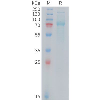 sp-PME M100104 TFRC Fig.1 SDS PAGE 1