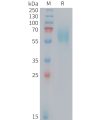 sp-PME M100105 CD98 Fig.1 SDS PAGE 1